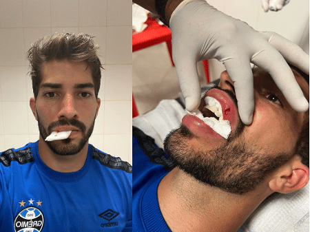 Polícia identifica torcedor que atirou celular em Lucas Silva