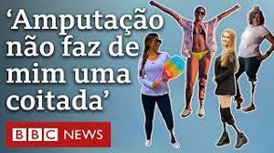 As histórias de recomeço de mulheres que sofreram amputação