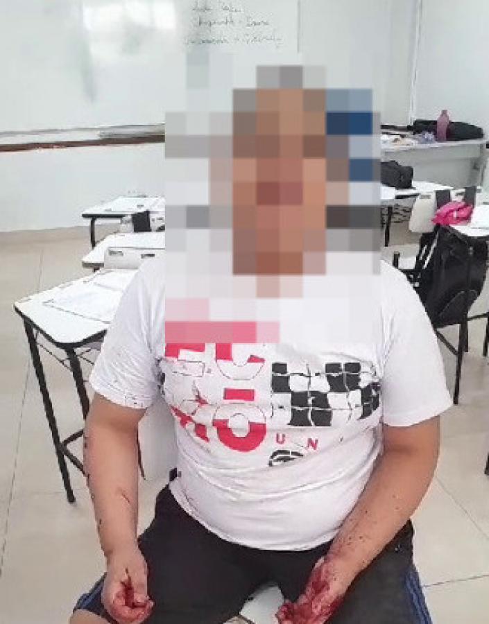 Aluno autista é agredido com 2 socos por professor durante aula na rede estadual