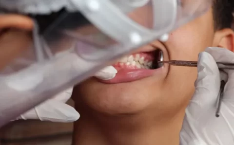 Mulheres negras são as que mais sofrem com a perda dentária, aponta estudo